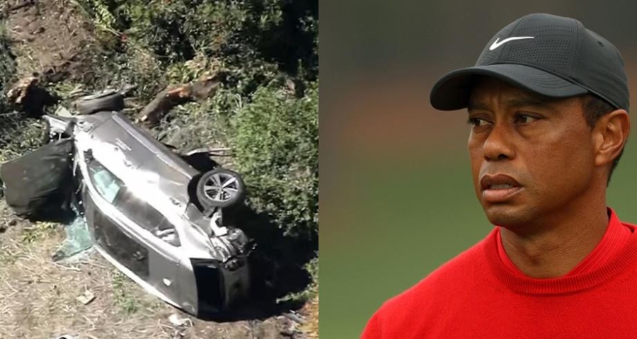 تايغر وودز يتعرض لحادث سير خطير ويخضع لجراحة عاجلة في الساق