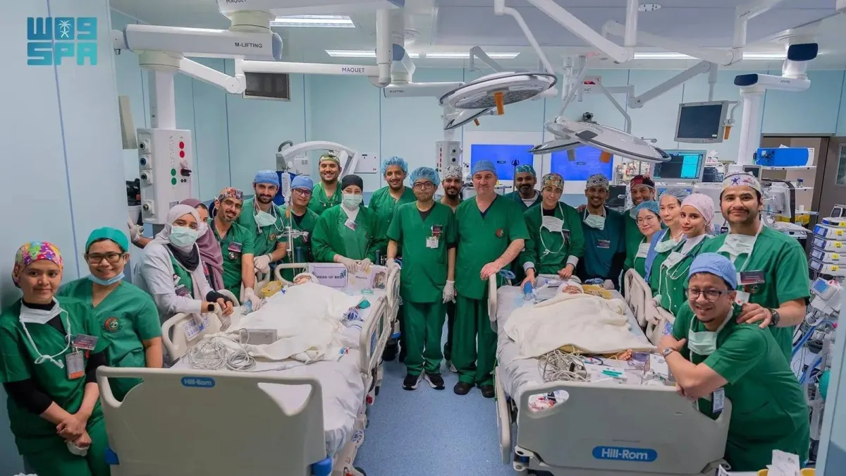 إنجاز طبي بارز في فصل توأم فلبيني معقد في السعودية
