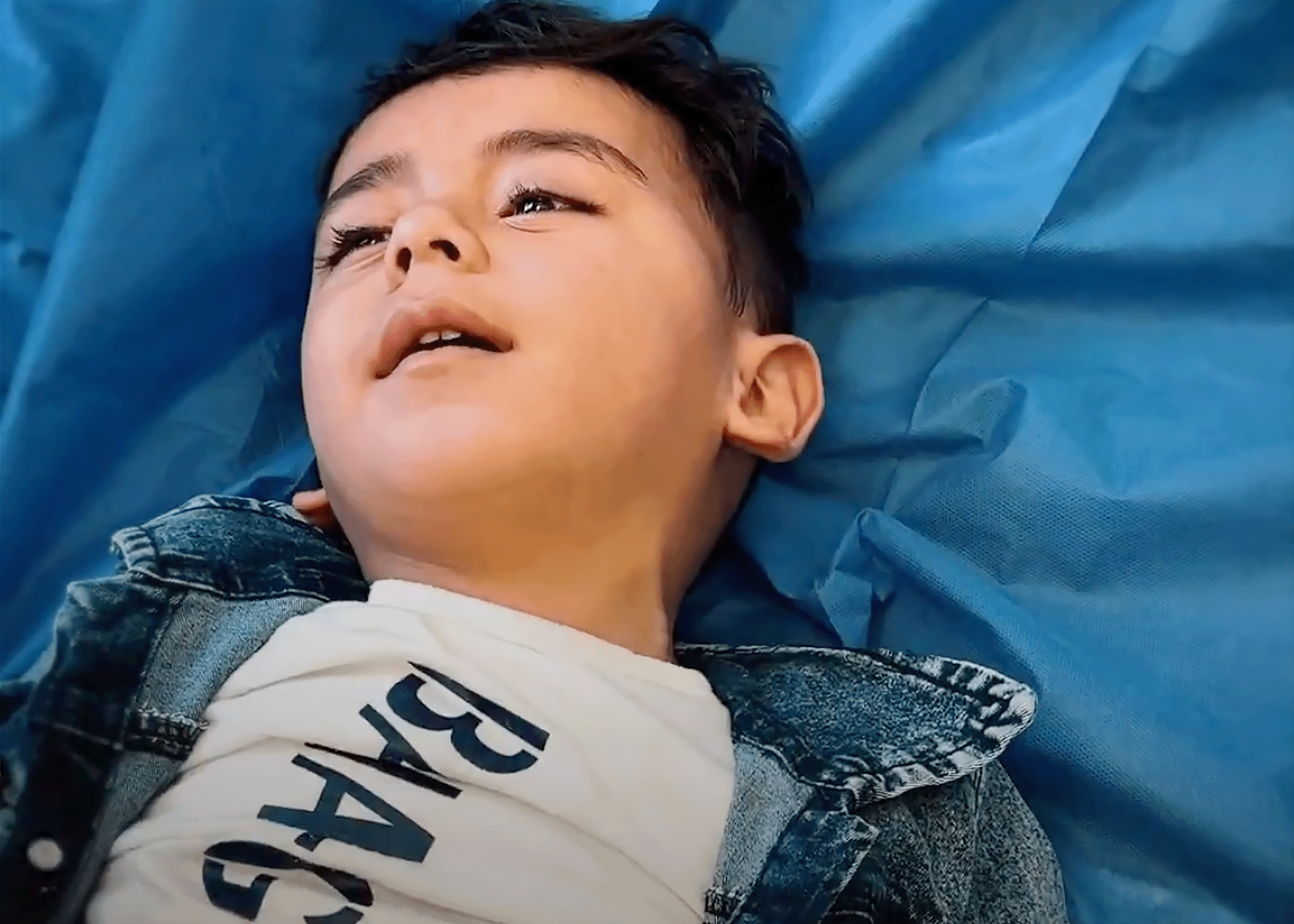 إنقاذ طفل في غزة من الإعاقة رغم التحديات الصحية