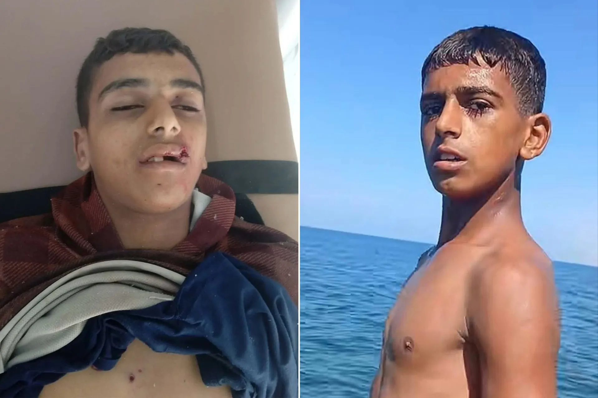 مأساة فتى فلسطيني يختتم حياته برصاصة الاحتلال أثناء الصيد