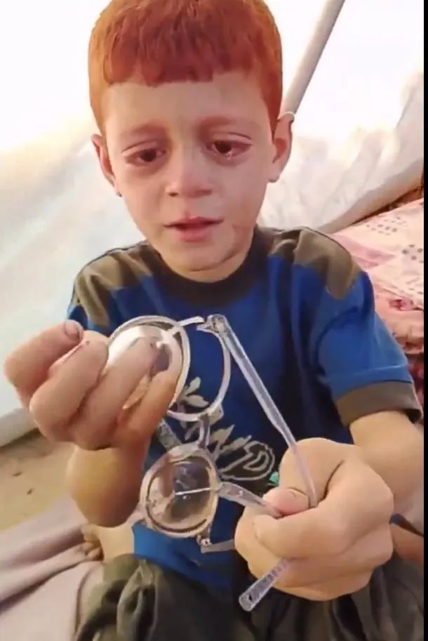 طفل فلسطيني يعاني من ضعف البصر يتصدر اهتمام العالم بعد حادثة مؤلمة