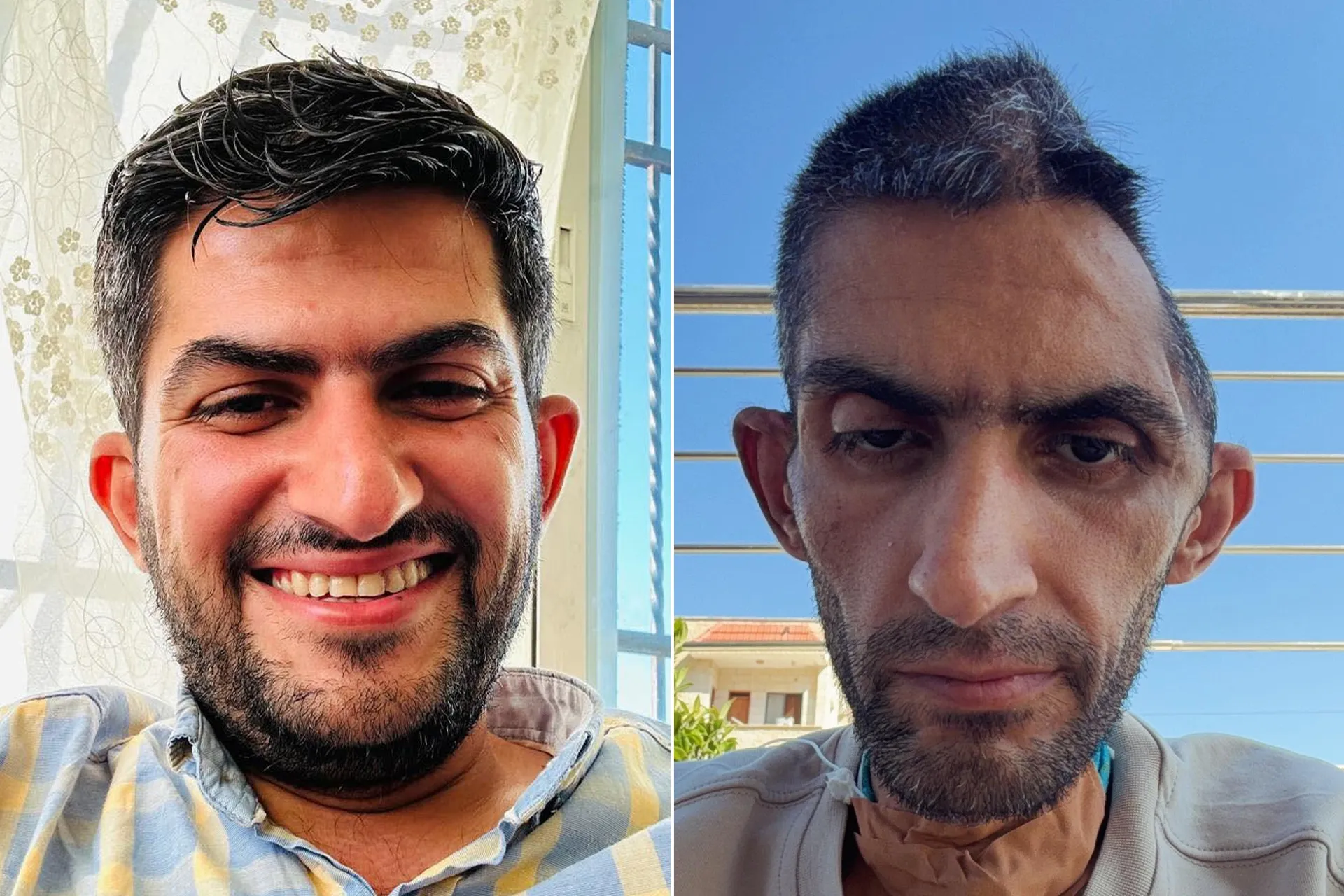 آثار التعذيب في سجون الاحتلال تبرز معاناة الأسرى