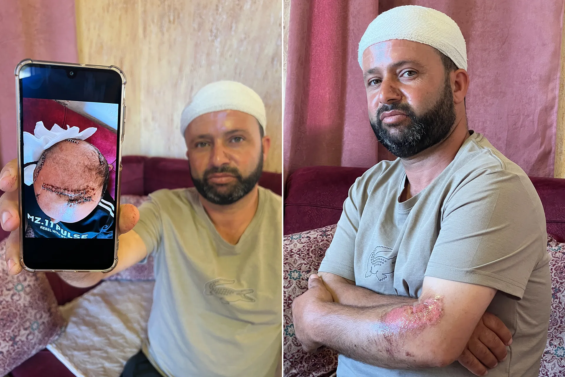 شهادات حية من قلب الجحيم: كيف تحولت طرقات الضفة الغربية الى مصائد للموت على يد المستوطنين